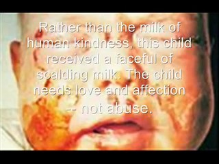 Extreme Child Abuse, Please, Open Your Eyes.