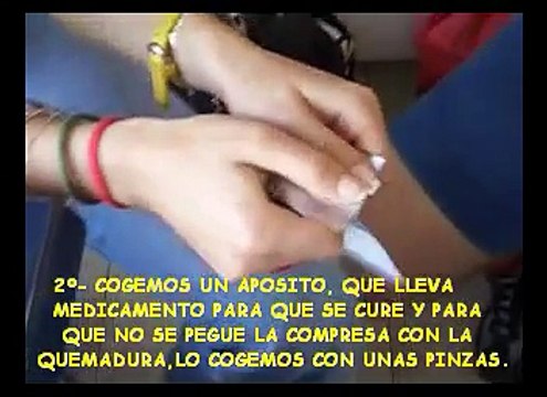 Video De Primeros Auxilios Quemaduras: cómo actuar ante una quemadura normal