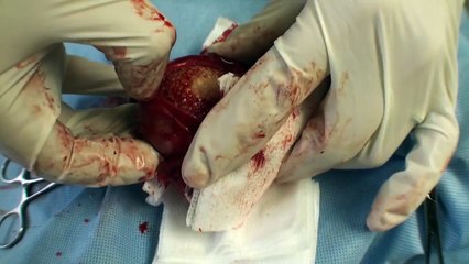 Un chien avec un gros calcul dans la vessie