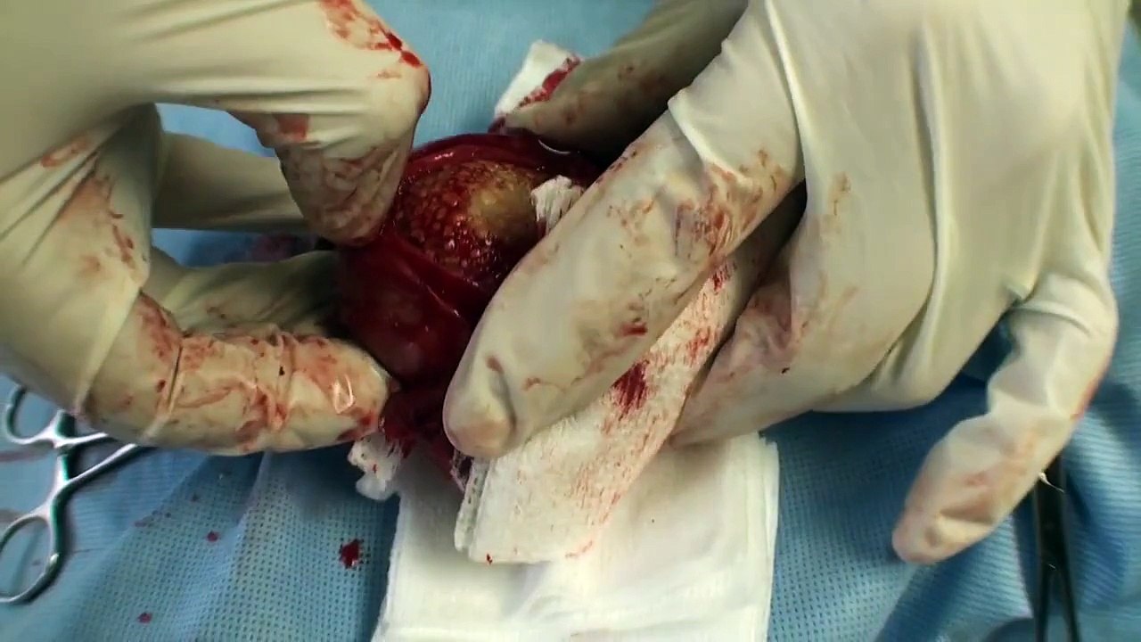 Un chien avec un gros calcul dans la vessie