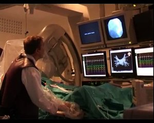 Métodos diagnósticos-Estudio electrofisiológico