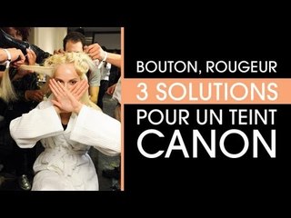 Maquillage : 3 trucs pour attenuer ses rougeurs