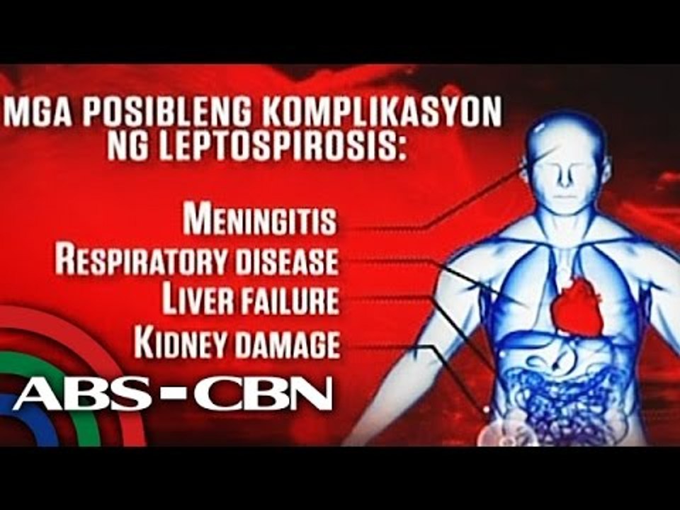 How to prevent the leptospirosis