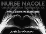 Nursing Education | Normal Chest X-Ray & Landmarks