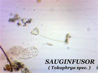 Wunderwelt des Mikrokosmos - Teil 10 : Sauginfusor ( Tokophrya spec. )