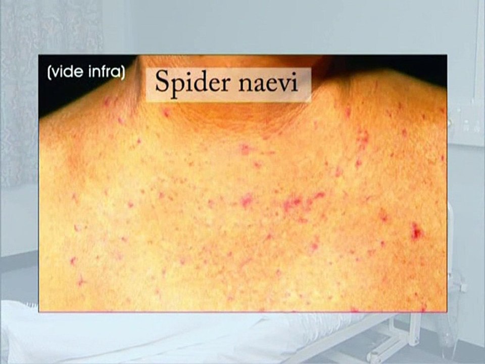 Gastrointestinal System Physical Examination