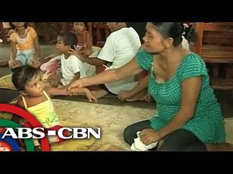 Mga buntis sa evacuation centers sa Albay, hirap