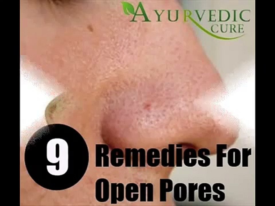 9 home remedies For Open Pores........ کیل معاسوں سے بننے والے سوراخوں کے لے ٹوٹکے