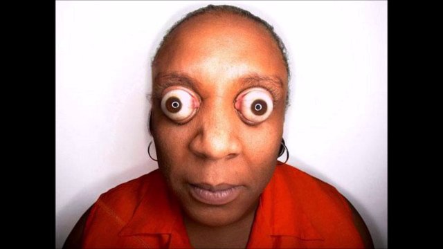 Records corporels les plus fous - Compilation de Photos dingues