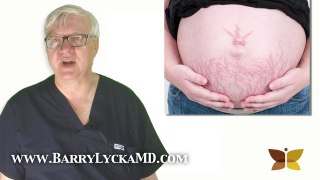Stretch Marks - How Can You Get Rid Of Them? Dr Barry Lycka