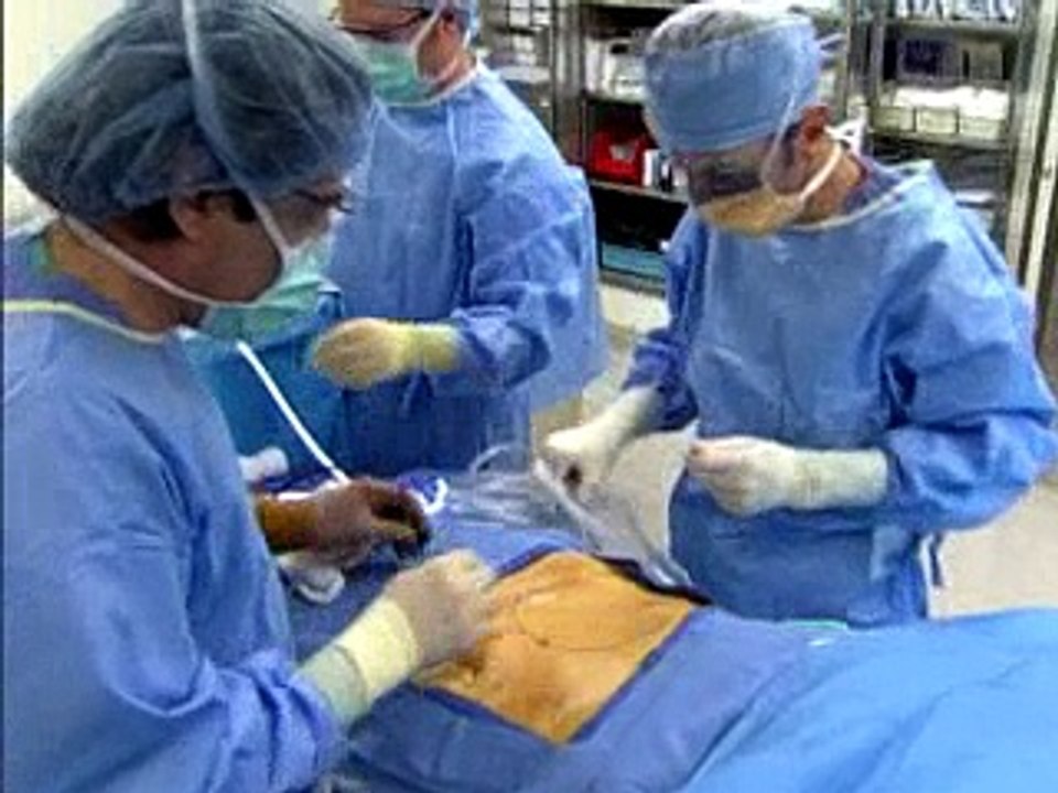 Live: Hand Assisted Laparoscopic Radical Nephrectomy