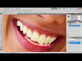 Dicas - Photoshop: como deixar os dentes brancos - Baixaki