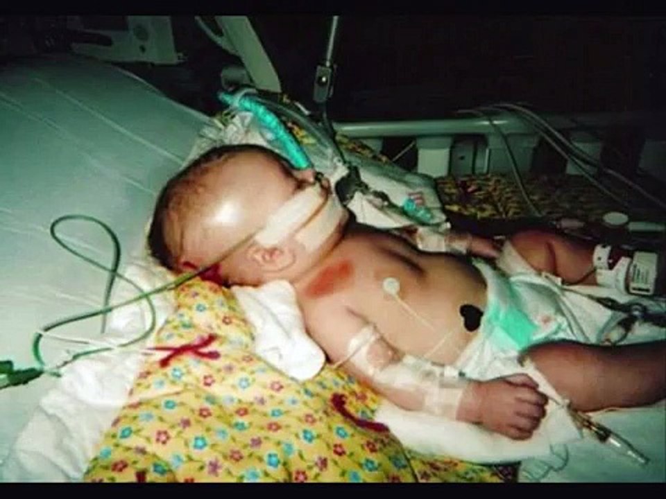 Shaken Baby Syndrome Memorial