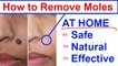 How to Remove Moles? Learn How to Remove Skin Moles at Home