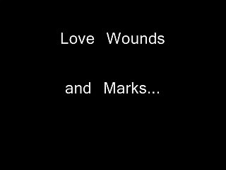 Love Hurts Lyrics 🎶