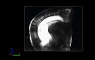 3D rendering of fluorescence images taken using SeeDB and a two-photon laser scanning microscope