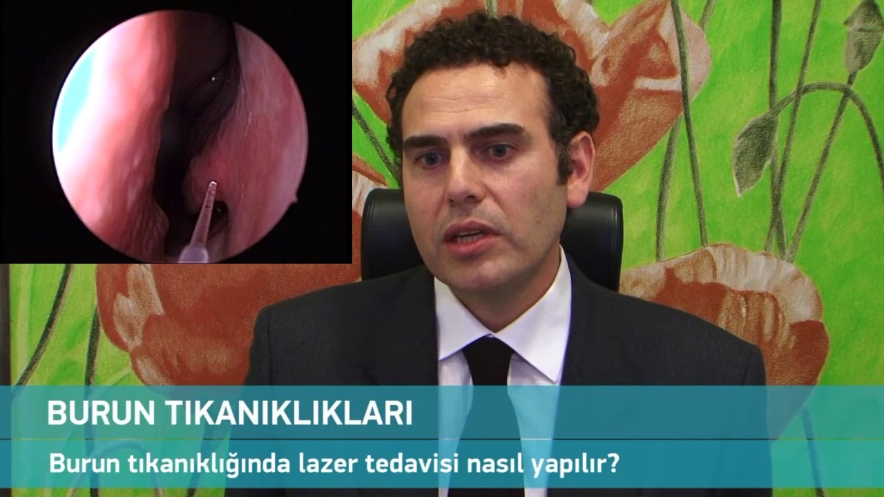Lazerli Burun Eti Küçültme Ameliyatı Dailymotion Video
