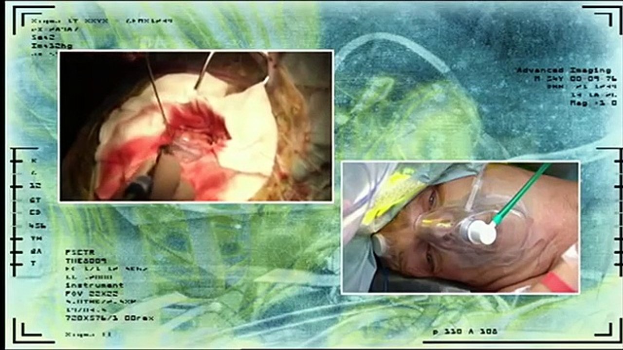 Awake through brain surgery (1 of 3)