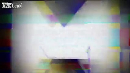 Heart Beating Can Be Visible From Outside A Man's Chest