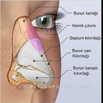 Burun Estetiği Ameliyatı, Açık Rinoplasti Videosu | Dr. Nazmi Bayçın