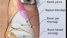 Burun Estetiği Ameliyatı, Açık Rinoplasti Videosu | Dr. Nazmi Bayçın