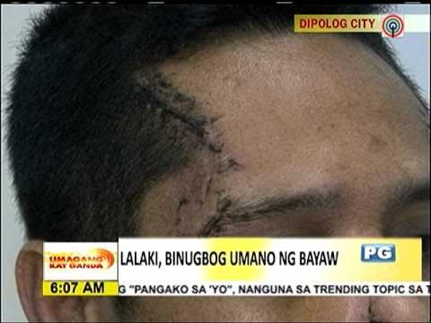 Lalaki, binugbog ng sariling bayaw