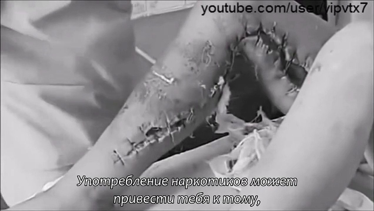 Скажи наркотикам - нет!