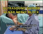 Ulnar nerve block (ultrasound guided)