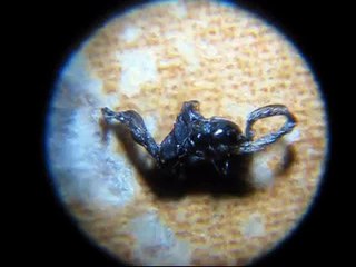 Nasty bug removed from eye! 20-40x microscope