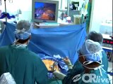 Laparoscopic Gastric Bypass and Sleeve Gastrectomy Surgery