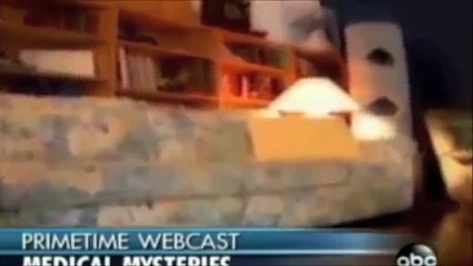 Alice in Wonderland Syndrome