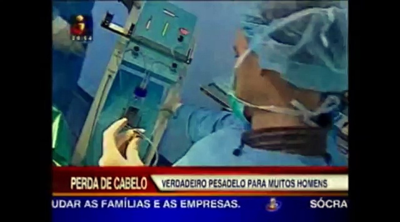 TVI Telejornal - Implantes Capilares