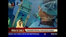TVI Telejornal - Implantes Capilares