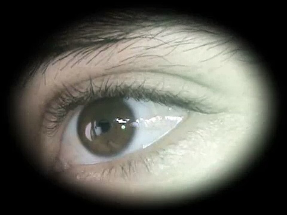 Mi Ojo - My eye