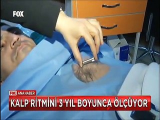 Ritm bozukluğu yüzünden ölümlere uzaktan takip olanağı veren cihazı SGK karşılamıyor