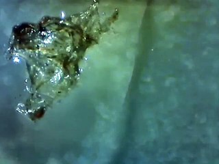 Understanding the Silent Superbug