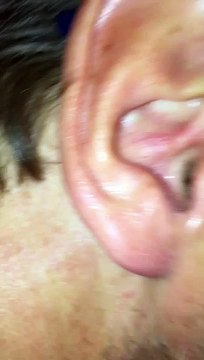 Un truc horrible dans l'oreille