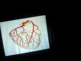 4- Formation Continue: Anatomie et Physiologie du Coeur Humain. le 23 10 2010