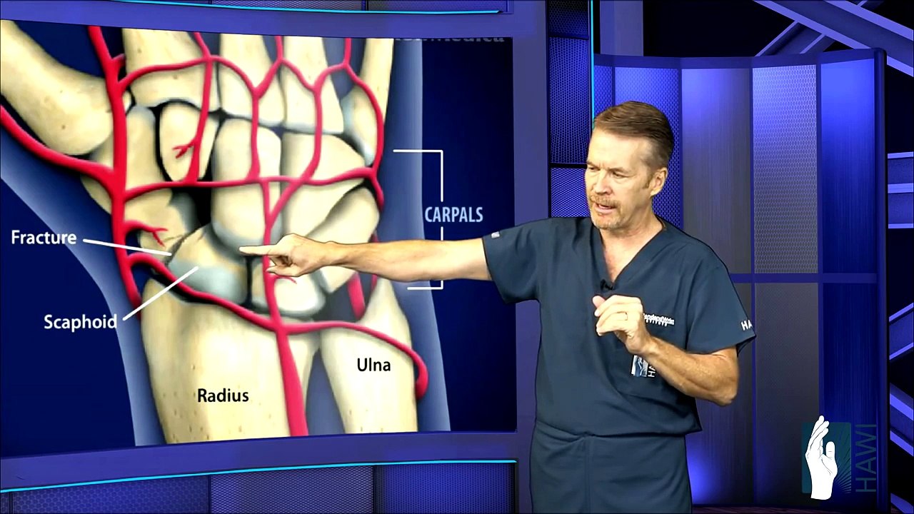 Wrist Fracture Surgery