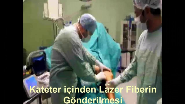 Varis Lazer Tedavisi - Prof. Dr. İlhan Gölbaşı