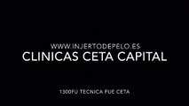 CLINICAS CETA CAPITAL www.injertodepelo.es