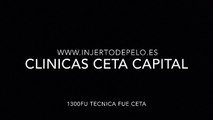 CLINICAS CETA CAPITAL www.injertodepelo.es
