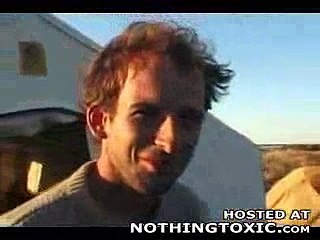 Disgusting Botflies Get Removed From Guys Skin