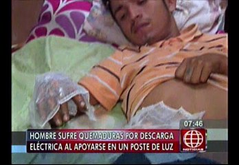 Rímac: Hombre se apoyó en caja de luz y terminó con graves quemaduras
