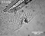 Rapid Leukocyte Recruitment