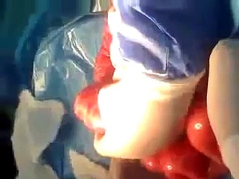 Removing Intestinal Worms and Parasites from a 3 Year Old