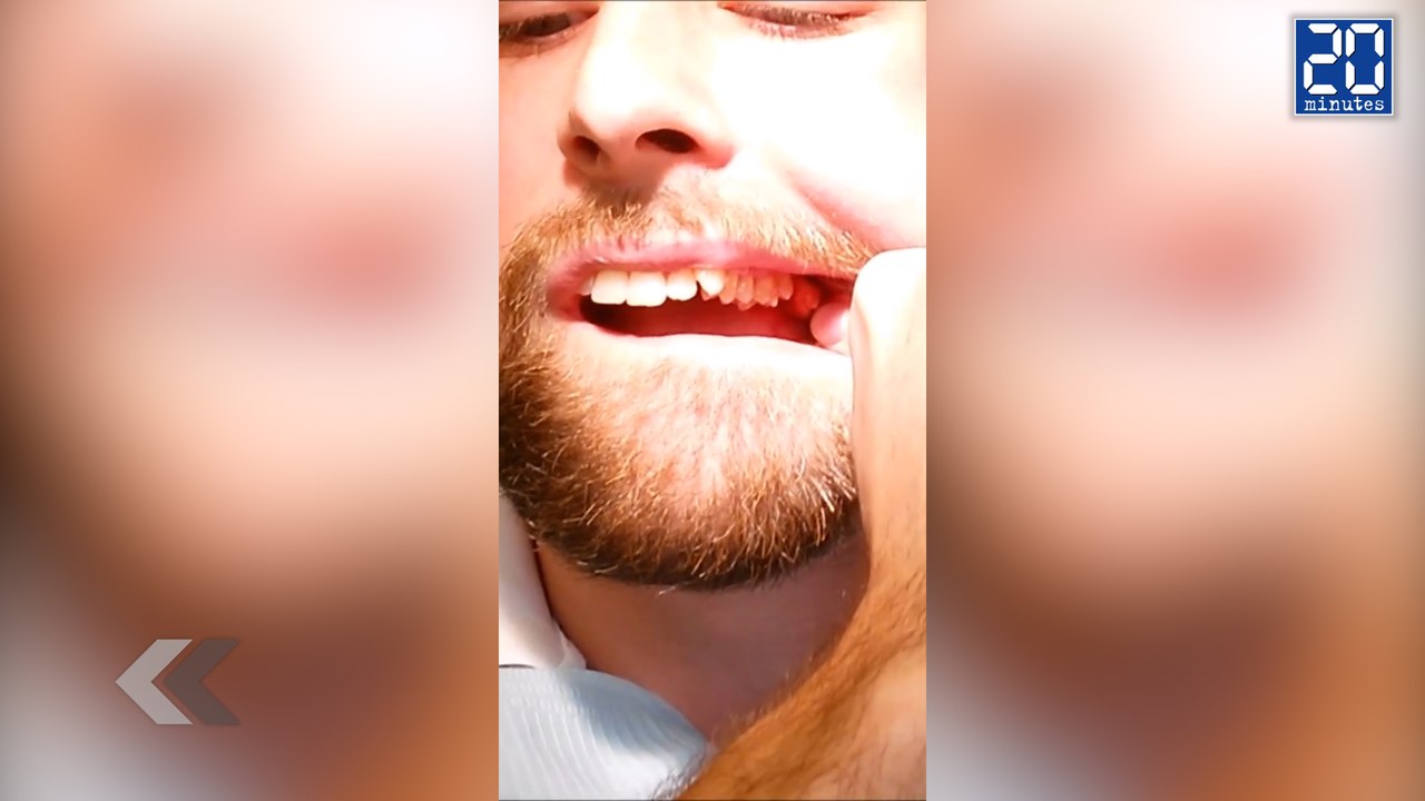 Un étudiant dentiste s'enlève une dent de sages...