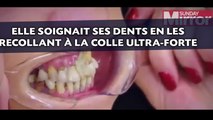 Elle soignait ses dents en les recollant à la colle ultra-forte