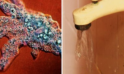 Naegleria virus become more dangerous for Karachi