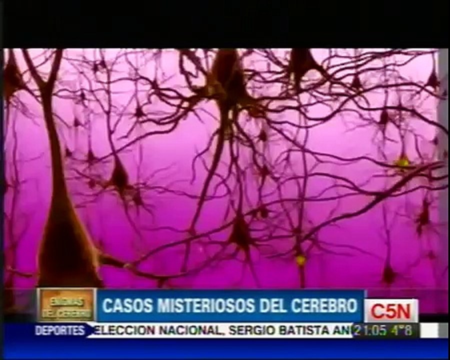 C5N - ENIGMAS DEL CEREBRO - CASOS MISTERIOSOS DEL CEREBRO - 1
